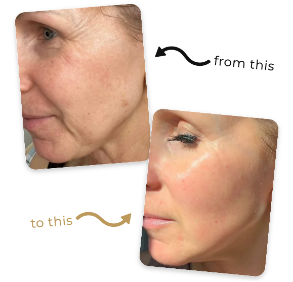 Review by Smoother transformation