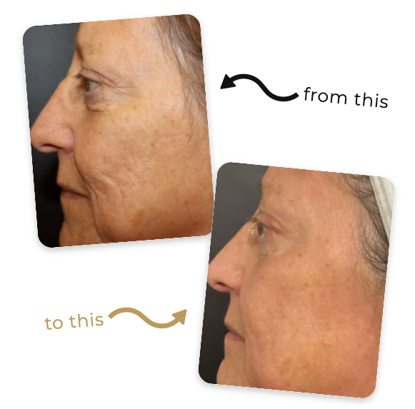 Review by Confidence Restored